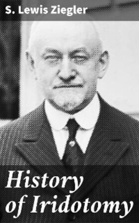 Ziegler |  History of Iridotomy | eBook | Sack Fachmedien