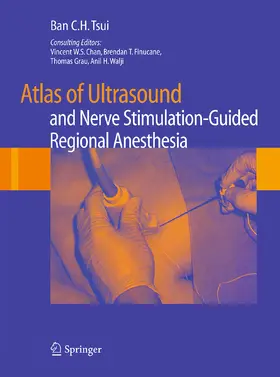 Tsui |  Atlas of Ultrasound- and Nerve Stimulation-Guided Regional Anesthesia | eBook | Sack Fachmedien