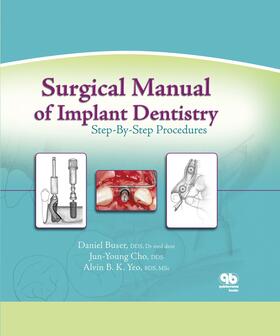Buser / Cho / Yeo | Surgical Manual of Implant Dentistry | E-Book | sack.de