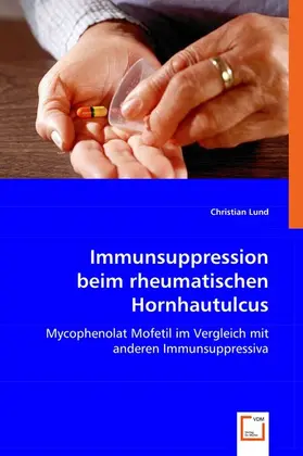 Lund |  Immunsuppression beim rheumatischen Hornhautulcus | eBook | Sack Fachmedien