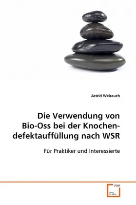 MSc. |  Die Verwendung von Bio-Oss bei der Knochendefektauffüllung nach WSR | eBook | Sack Fachmedien