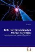 Kaiser |  Tiefe Hirnstimulation bei Morbus Parkinson | eBook | Sack Fachmedien