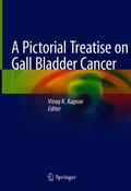 Kapoor |  A Pictorial Treatise on Gall Bladder Cancer | eBook | Sack Fachmedien