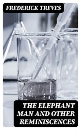 Treves | The Elephant Man and Other Reminiscences | E-Book | www.sack.de