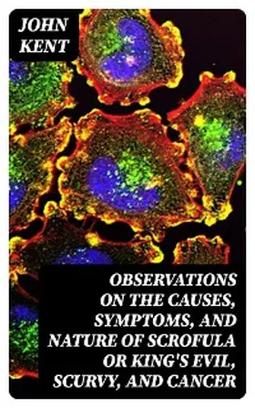 Kent |  Observations on the Causes, Symptoms, and Nature of Scrofula or King's Evil, Scurvy, and Cancer | eBook | Sack Fachmedien