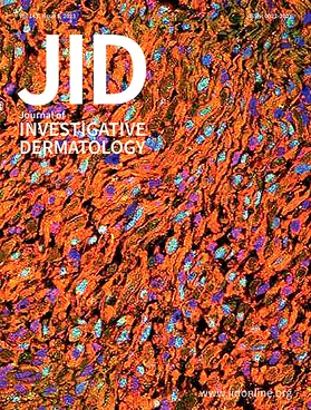 Journal of Investigative Dermatology | Elsevier | Zeitschrift | sack.de