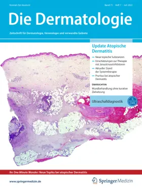 Die Dermatologie | SpringerMedizin | Zeitschrift | www.sack.de