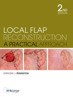 Penington | Local Flap Reconstruction | Buch | 978-0-07-027838-7 | sack.de