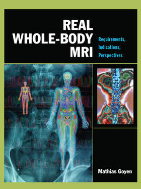 Goyen | Real Whole-Body Mri: Requirements, Indications, Perspectives | Buch | sack.de