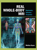 Goyen |  Real Whole-Body Mri: Requirements, Indications, Perspectives | Buch |  Sack Fachmedien