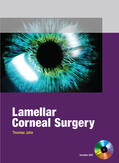 John |  Lamellar Corneal Surgery | Buch |  Sack Fachmedien