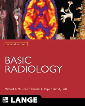 Chen / Pope / Ott |  Basic Radiology, Second Edition | Buch |  Sack Fachmedien