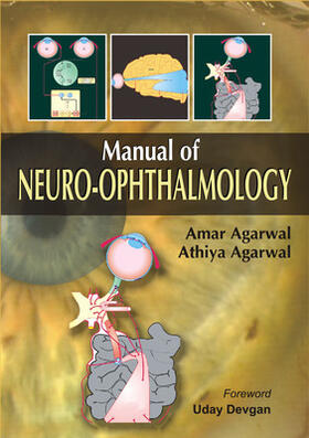 Agarwal | Manual of Neuro-Ophthalmology | Buch | 978-0-07-163231-7 | sack.de