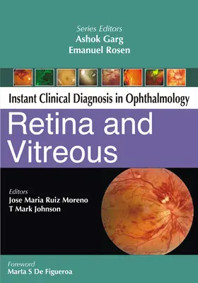 Moreno / Johnson |  Retina and Vitreous | Buch |  Sack Fachmedien