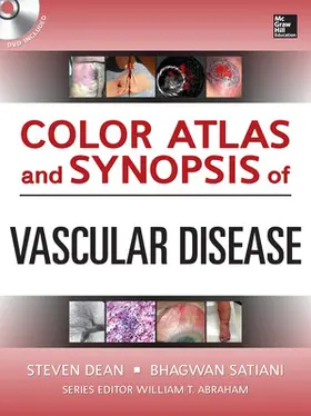 Dean / Satiani |  Color Atlas and Synopsis of Vascular Disease [With CDROM] | Buch |  Sack Fachmedien