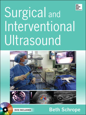 Schrope |  Surgical and Interventional Ultrasound | Buch |  Sack Fachmedien