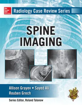 Grayev / Ali / Gretch | Radiology Case Review Series: Spine | Buch | 978-0-07-179808-2 | www.sack.de