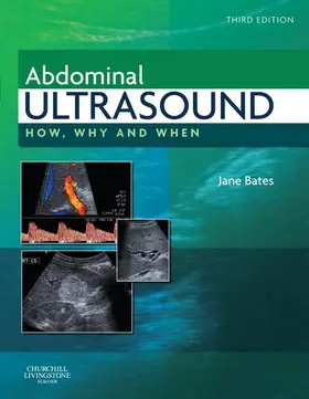  Abdominal Ultrasound | eBook | Sack Fachmedien