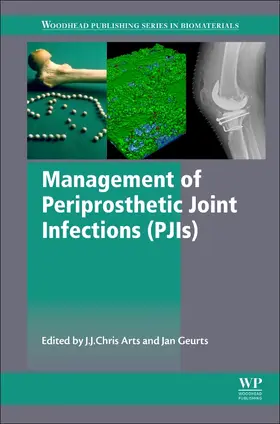 Arts / Geurts |  Management of Periprosthetic Joint Infections (PJIs) | Buch |  Sack Fachmedien
