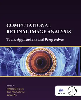 Trucco / MacGillivray / Xu |  Computational Retinal Image Analysis | eBook | Sack Fachmedien