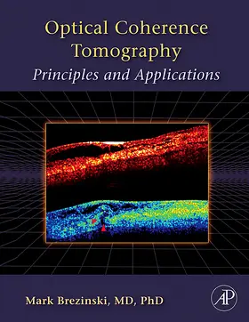 Brezinski | Optical Coherence Tomography | Buch | 978-0-12-133570-0 | sack.de