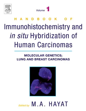 Hayat |  Handbook of Immunohistochemistry and in Situ Hybridization of Human Carcinomas | Buch |  Sack Fachmedien