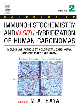 Hayat | Handbook of Immunohistochemistry and in Situ Hybridization of Human Carcinomas | Buch | sack.de