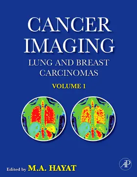 Hayat |  Cancer Imaging | Buch |  Sack Fachmedien