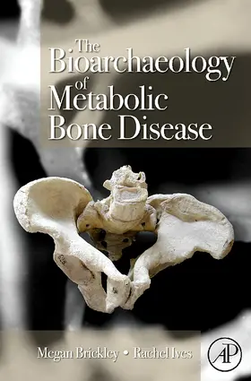 Brickley / Ives | The Bioarchaeology of Metabolic Bone Disease | Buch | 978-0-12-370486-3 | sack.de