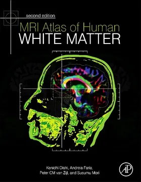 Oishi / Faria / Zijl |  MRI Atlas of Human White Matter | eBook | Sack Fachmedien