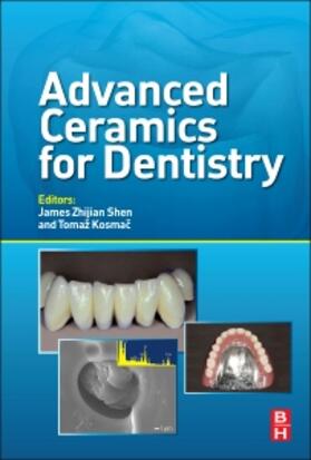 Shen | Advanced Ceramics for Dentistry | Buch | 978-0-12-394619-5 | sack.de