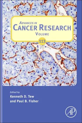 Fisher |  Advances in Cancer Research | eBook | Sack Fachmedien