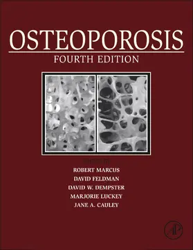 Marcus MD / Marcus / Dempster | Osteoporosis | E-Book | sack.de