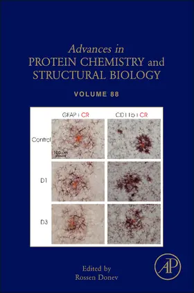 Inflammation in Neuropsychiatric Disorders | Buch | 978-0-12-398314-5 | sack.de
