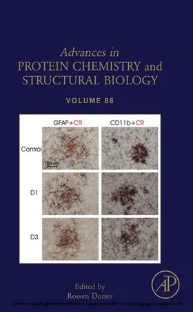 Donev | Inflammation in Neuropsychiatric Disorders | E-Book | sack.de