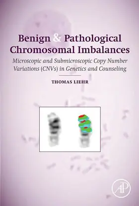 Liehr | Benign and Pathological Chromosomal Imbalances | E-Book | www.sack.de