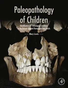 Lewis | Paleopathology of Children | E-Book | sack.de