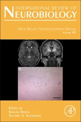 Metal Related Neurodegenerative Disease | Buch | 978-0-12-410502-7 | sack.de