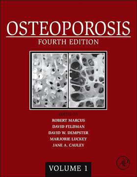 Marcus / Dempster / Cauley | Osteoporosis | Buch | 978-0-12-415853-5 | sack.de