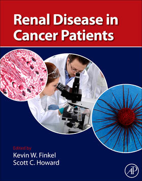 Finkel / Howard | Renal Disease in Cancer Patients | Buch | 978-0-12-415948-8 | sack.de