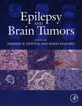Newton MD in Oncology-Neurosurgery / Maschio |  Epilepsy and Brain Tumors | eBook | Sack Fachmedien