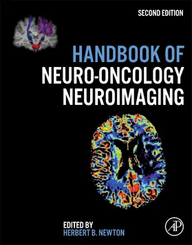 Newton | Handbook of Neuro-Oncology Neuroimaging | Buch | 978-0-12-800945-1 | sack.de