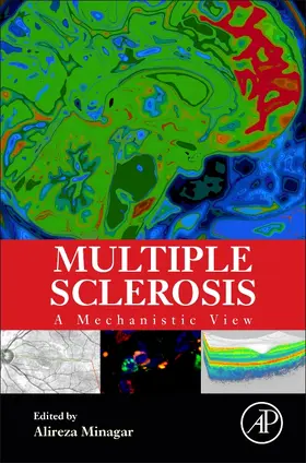 Minagar / Minagar MD |  Multiple Sclerosis | eBook | Sack Fachmedien