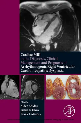 Abidov / Oliva / Marcus | Cardiac MRI in Diagnosis, Clinical Management, and Prognosis of Arrhythmogenic Right Ventricular Cardiomyopathy/Dysplasia | E-Book | sack.de