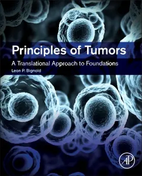 Bignold |  Principles of Tumors | Buch |  Sack Fachmedien
