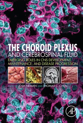 Neman / Chen | The Choroid Plexus and Cerebrospinal Fluid | E-Book | www.sack.de