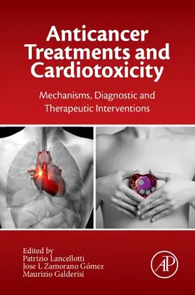 Lancellotti / Zamorano / Galderisi | Anti-cancer Treatments and Cardiotoxicity | Buch | 978-0-12-802509-3 | sack.de