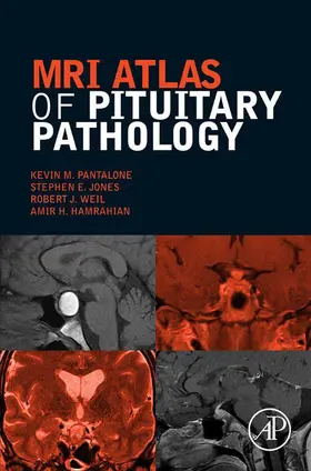 Pantalone DO / Jones / Weil | MRI Atlas of Pituitary Pathology | E-Book | sack.de