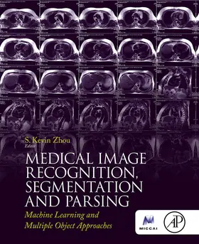 Zhou |  Medical Image Recognition, Segmentation and Parsing | eBook | Sack Fachmedien