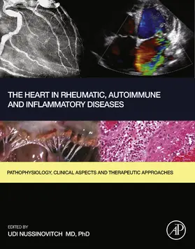 Nussinovitch |  The Heart in Rheumatic, Autoimmune and Inflammatory Diseases | eBook | Sack Fachmedien